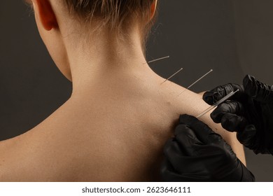 The Science and Art of Acupuncture: Ancient Wisdom Meets Modern Medicine