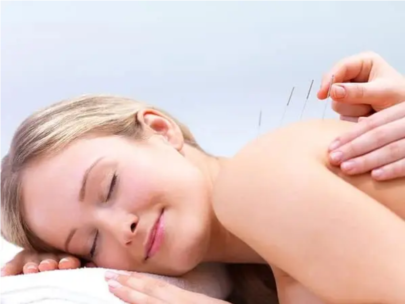 Acupuncture treatment at Snake River Acupuncture