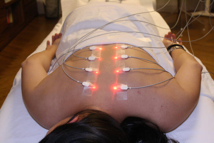 Laser Acupuncture Therapy Boise - Pain-Free Relief Without Needles